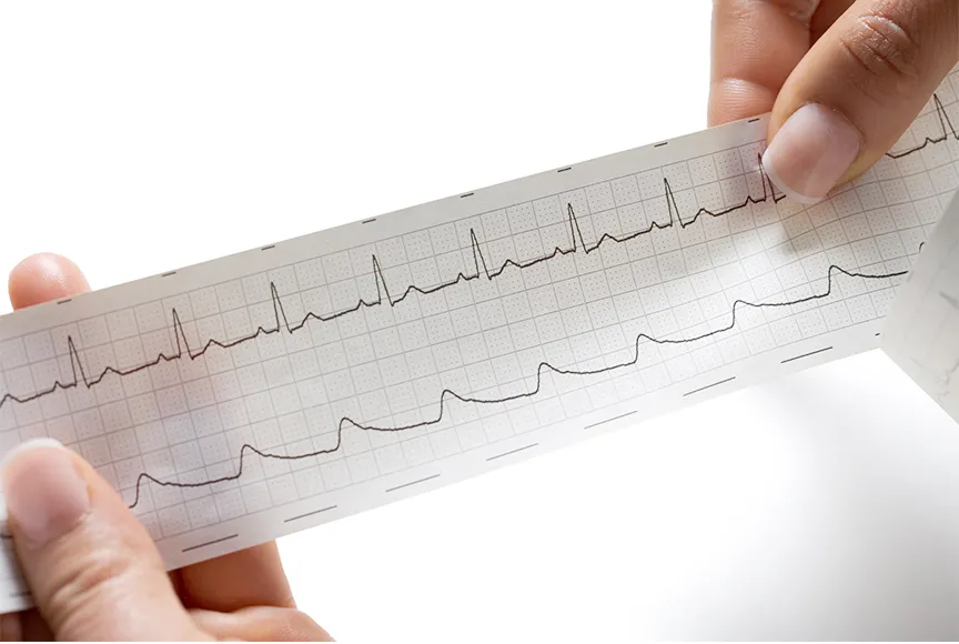 ecg-paper4